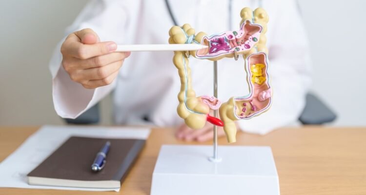 Ciri Kanker Usus yang Perlu Diwaspadai Sebelum Keluhan Semakin Berat